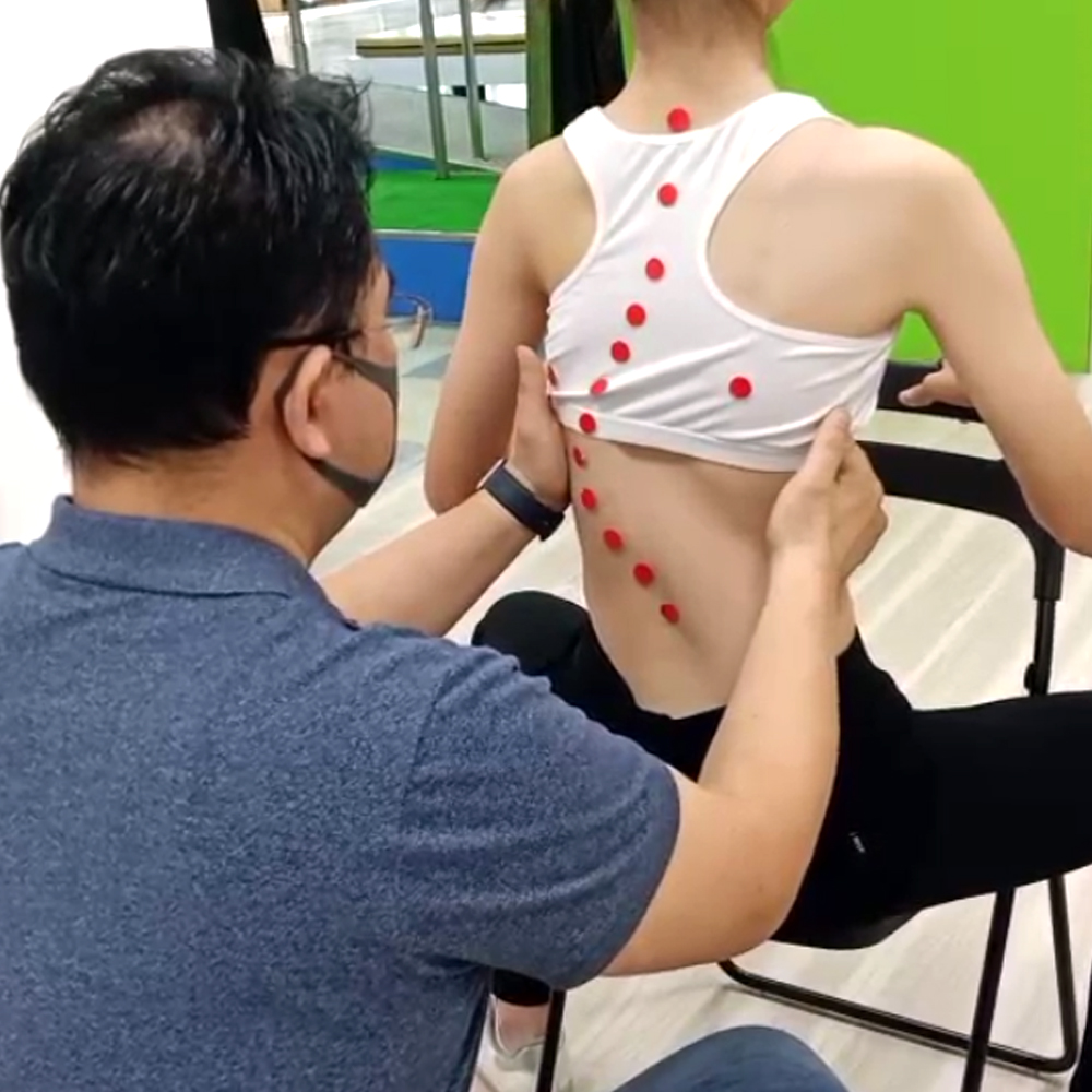 脊椎側彎掃描前所做的科學運動擺位訓練跟PSSE特定性脊椎復健運動有何不同？